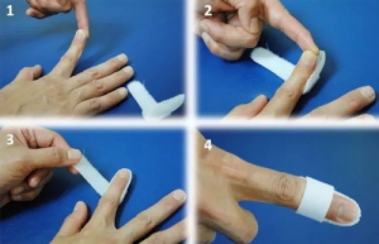 Cum tratam taieturile, zgarieturile si ranile 