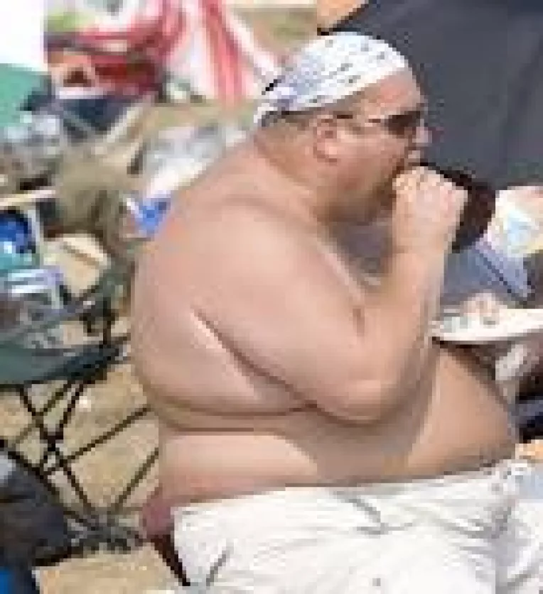 Obezitatea poate sa ucida